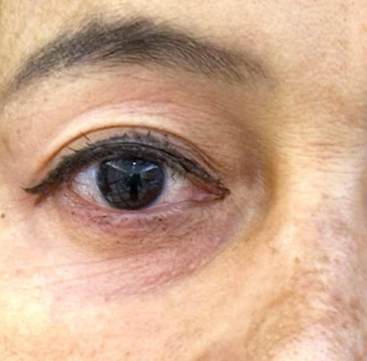 Before/After Image